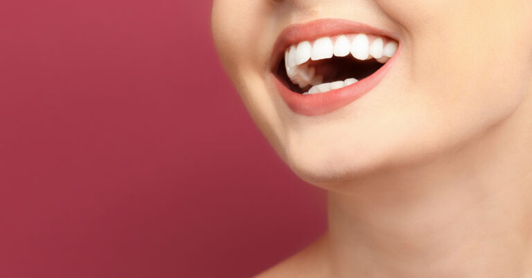 clareamento dental em navegantes